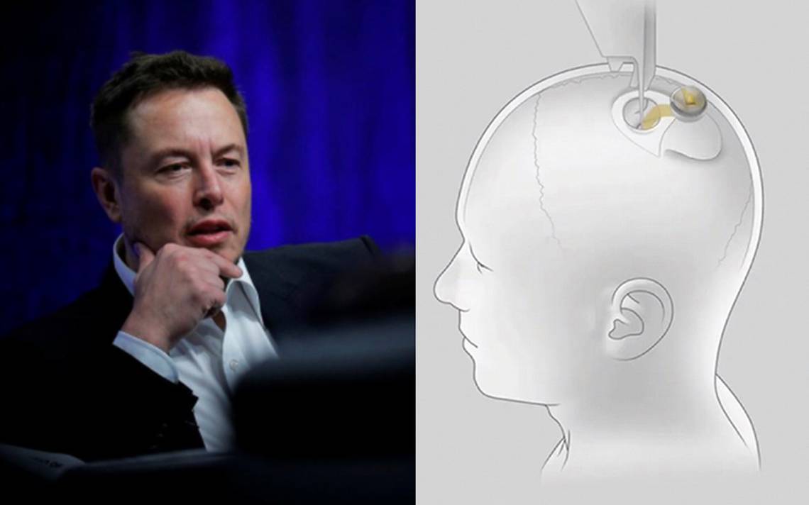 Todo Sobre El Chip Que Elon Musk Y Neuralink Desarrollan Para El Cerebro Humano